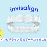 invisalign インビザライン アメリカ 一年　ビフォーアフター